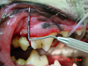 Dental Care and Procedures